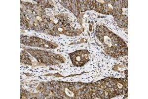 IHC analysis of Claudin 3/CLDN3 using anti-Claudin 3/CLDN3 antibody (ABIN7599626).