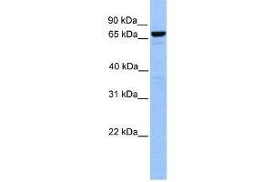 WB Suggested Anti-MTA2  Antibody Titration: 0. (MTA2 antibody  (Middle Region))