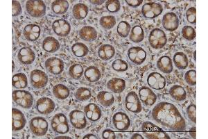 Immunoperoxidase of monoclonal antibody to NDST1 on formalin-fixed paraffin-embedded human small Intestine. (NDST1 antibody  (AA 38-136))