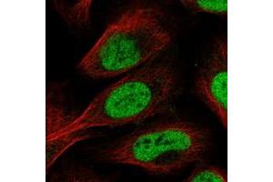 Immunofluorescent staining of human cell line U-2 OS with SFRS2IP polyclonal antibody  at 1-4 ug/mL dilution shows positivity in nucleus but not nucleoli. (SCAF11 antibody)