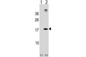 Western blot analysis of LEP antibody and 293 cell lysate (2 ug/lane) either nontransfected (Lane 1) or transiently transfected (2) with the human gene. (Leptin antibody  (AA 8-37))