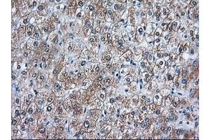 Immunohistochemical staining of paraffin-embedded Human prostate tissue using anti-RANGAP1 mouse monoclonal antibody. (RANGAP1 antibody)