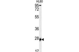 Western Blotting (WB) image for anti-Dermatopontin (DPT) antibody (ABIN3003244) (Dermatopontin antibody)