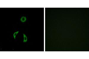 Peptide - +Western blot analysis of extracts from HUVEC cells, using FZD3 antibody. (FZD3 antibody  (Internal Region))