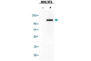 Western blot using ASAP3 polyclonal antibody  shows detection of ASAP3 in NIH/3T3 cells over-expressing the protein. (ASAP3 antibody)