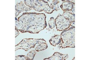 Immunohistochemistry of paraffin-embedded human placenta using Placental lactogen (CSH1) (CSH1) Rabbit mAb (ABIN7266353) at dilution of 1:100 (40x lens). (CSH1 antibody)