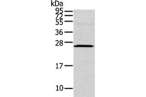 Gel: 12 % SDS-PAGE, Lysate: 40 μg, Lane: Human fetal intestines tissue, Primary antibody: ABIN7190229(CFC1 Antibody) at dilution 1/200 dilution, Secondary antibody: Goat anti rabbit IgG at 1/8000 dilution, Exposure time: 2 minutes (CFC1 antibody)