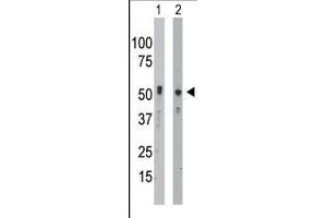 The anti-BCKDK Pab (ABIN391130 and ABIN2841253) is used in Western blot to detect BCKDK in mouse intestine tissue lysate (Lane 1) and Hela cell lysate (Lane 2). (BCKDK antibody  (C-Term))