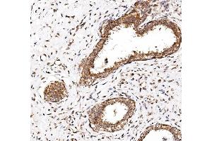 IHC analysis of NDP52/CALCOCO2 using anti-NDP52/CALCOCO2 antibody (ABIN7599401). (CALCOCO2 antibody  (AA 1-446))