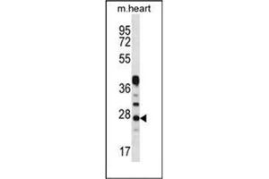 Western blot analysis of Beta-crystallin A3 Antibody  in Mouse heart tissue lysates (35ug/lane). (CRYBA1 antibody  (Middle Region))