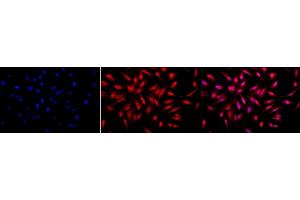 Immunocytochemistry/Immunofluorescence analysis using Rabbit Anti-p33 ING1 Polyclonal Antibody (ABIN361701).