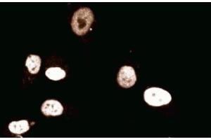 Immunofluorescent staining of Human Endothelial cells. (MCM2 antibody  (AA 725-888))
