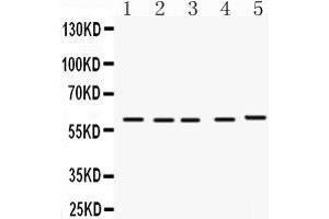 Western Blotting (WB) image for anti-Flavin Containing Monooxygenase 1 (FMO1) (AA 334-363), (C-Term) antibody (ABIN3042396)