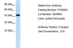 Lane: Jurkat cell LysateAntibody Dilution: 0. (Anti-MBP-1 (Middle Region) antibody)
