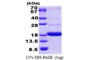 SDS-PAGE (SDS) image for CD300a (CD300A) (AA 18-128) protein (His tag) (ABIN5853118) (CD300a Protein (CD300A) (AA 18-128) (His tag))