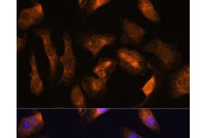 Immunofluorescence analysis of U-2 OS cells using RPS17 Polyclonal Antibody at dilution of 1:100. (RPS17 antibody)