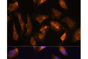 Immunofluorescence analysis of U-2 OS cells using RPS17 Polyclonal Antibody at dilution of 1:100.