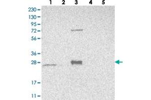 Western blot analysis of Lane 1: RT-4, Lane 2: U-251 MG, Lane 3: Human Plasma, Lane 4: Liver, Lane 5: Tonsil with MRPS15 polyclonal antibody  at 1:250-1:500 dilution. (MRPS15 antibody)