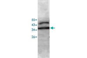 Western blot analysis of Jurkat cell lysate with PECI polyclonal antibody  at 1 : 500 dilution. (PECI/ECI2 antibody  (AA 2-227))