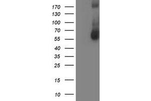 HEK293T cells were transfected with the pCMV6-ENTRY control (Left lane) or pCMV6-ENTRY AP2M1 (Right lane) cDNA for 48 hrs and lysed. (AP2M1 antibody  (AA 97-383))