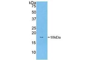 Detection of Recombinant BMPR2, Human using Polyclonal Antibody to Bone Morphogenetic Protein Receptor 2 (BMPR2) (BMPR2 antibody  (AA 27-150))