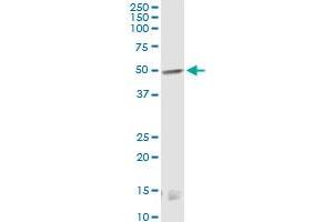 CNR1 monoclonal antibody (M01), clone 2F9. (CNR1 antibody  (AA 1-110))