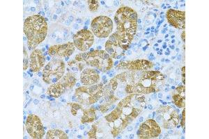 Immunohistochemistry of paraffin-embedded Mouse kidney using KLHL42 Polyclonal Antibody at dilution of 1:100 (40x lens).