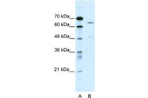 WB Suggested Anti-ACCN1 Antibody Titration:  0. (ACCN1 antibody  (C-Term))