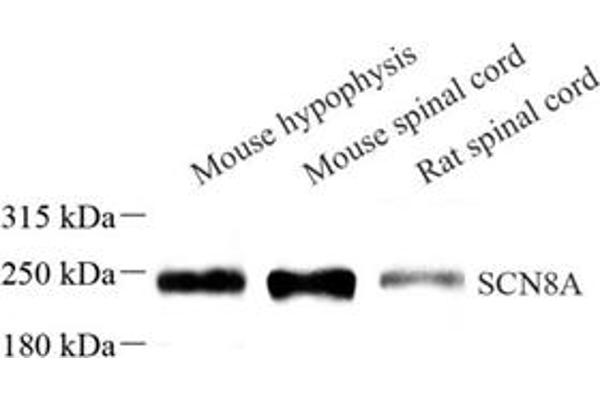 SCN8A antibody