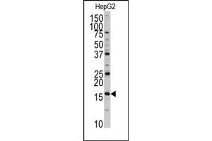 Image no. 1 for anti-DCTP Pyrophosphatase 1 (DCTPP1) (N-Term) antibody (ABIN357989) (DCTPP1 antibody  (N-Term))