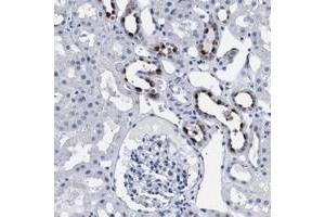 Immunohistochemical staining of human kidney with ATP6V0A4 polyclonal antibody  shows strong cytoplasmic positivity in cells in tubules at 1:50-1:200 dilution. (ATP6V0A4 antibody)