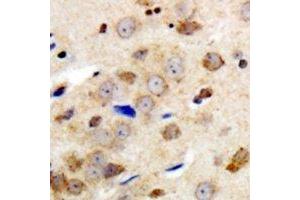 Immunohistochemical analysis of GABRG1 staining in human brain formalin fixed paraffin embedded tissue section. (GABRg1 antibody  (N-Term))