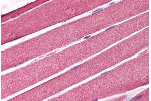 Human Skeletal Muscle (formalin-fixed, paraffin-embedded) stained with AICDA antibody ABIN214183 at 5 ug/ml followed by biotinylated goat anti-rabbit IgG secondary antibody ABIN481713, alkaline phosphatase-streptavidin and chromogen. (AICDA antibody  (C-Term))