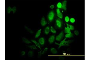 Immunofluorescence (IF) image for anti-Ribosomal Protein S6 Kinase, 70kDa, Polypeptide 1 (RPS6KB1) (AA 416-525) antibody (ABIN562722)