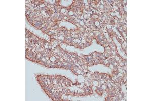 Immunohistochemistry of paraffin-embedded rat ovary using MOB4 antibody (ABIN6132926, ABIN6143935, ABIN6143936 and ABIN6220703) at dilution of 1:100 (40x lens). (MOBKL3 antibody  (AA 1-225))