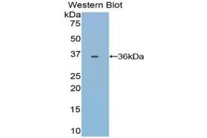 Detection of Recombinant TRF, Bovine using Polyclonal Antibody to Transferrin (TF) (Transferrin antibody)