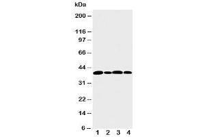 Western blot testing of Aurora B antibody and Lane 1:  rat liver (Aurora Kinase B antibody  (N-Term))