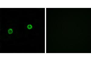 Peptide - +Western blot analysis of extracts from HeLa cells and COLO cells, using ACOT4 antibody.