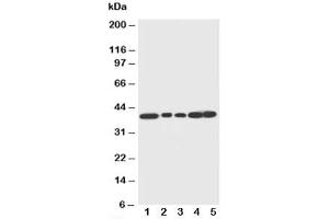 Western blot testing of Decorin antibody and Lane 1:  rat liver (Decorin antibody  (C-Term))