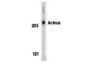 Western Blotting (WB) image for anti-Apoptotic Chromatin Condensation Inducer 1 (ACIN1) (Middle Region) antibody (ABIN1030843) (ACIN1 antibody  (Middle Region))