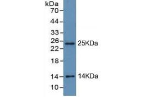Rabbit Detection antibody from the kit in WB with Positive Control: Sample BXPC-3 cell lysate. (Trypsin ELISA Kit)