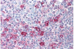 Human Tonsil (formalin-fixed, paraffin-embedded) stained with AKT1 antibody ABIN213755 at 5 ug/ml followed by biotinylated goat anti-rabbit IgG secondary antibody ABIN481713, alkaline phosphatase-streptavidin and chromogen. (AKT1 antibody  (pSer473))