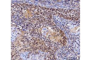 IHC analysis of MLH1 using anti-MLH1 antibody (ABIN7599691).