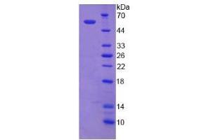 Image no. 1 for Thyroid Hormone Receptor, alpha (THRA) (AA 1-490) protein (His tag) (ABIN6236844)
