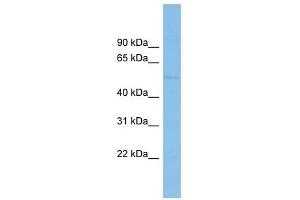 BEND7 antibody used at 1 ug/ml to detect target protein. (BEND7 antibody  (Middle Region))