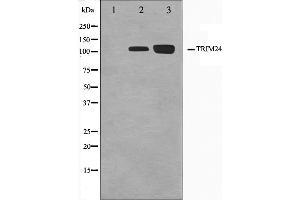 Western blot analysis on Jurkat and K562 cell lysate using TRIM24 Antibody. (TRIM24 antibody  (C-Term))