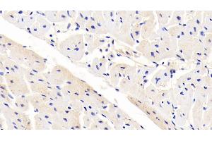 Detection of LRP6 in Human Cardiac Muscle Tissue using Polyclonal Antibody to Low Density Lipoprotein Receptor Related Protein 6 (LRP6) (LRP6 antibody  (AA 981-1213))