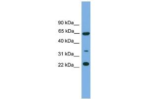 WB Suggested Anti-TRAPPC5 Antibody Titration: 0. (TRAPPC5 antibody  (N-Term))