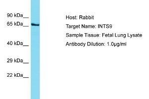 Host: Rabbit Target Name: INTS9 Sample Tissue: Human Fetal Lung Antibody Dilution: 1ug/ml (INTS9 antibody  (C-Term))