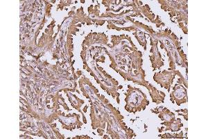 IHC analysis of YWHAE using anti-YWHAE antibody (ABIN7600163). (YWHAE antibody  (AA 16-163))